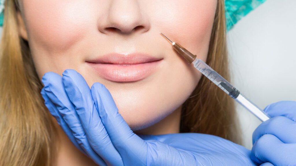 Collagen Booster: Hyperdilute Radiesse for Aurora’s Sagging Skin